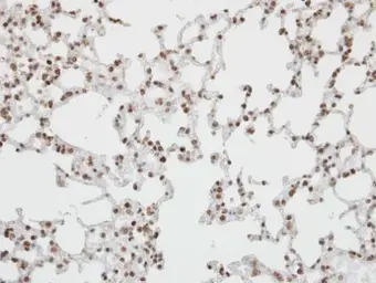 Anti-Pokemon antibody [C3], C-term used in IHC (Paraffin sections) (IHC-P). GTX104876