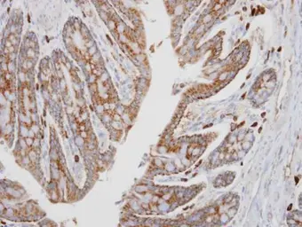 Anti-PKA C alpha antibody [N2C3] used in IHC (Paraffin sections) (IHC-P). GTX104934