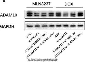 Anti-ADAM10 antibody [N2C1], Internal used in Western Blot (WB). GTX104940