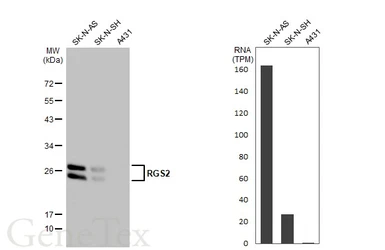 Anti-RGS2 antibody used in Western Blot (WB). GTX104944