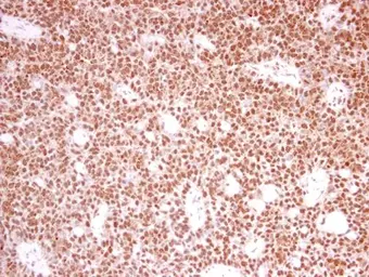 Anti-PRPF39 antibody [N2C1], Internal used in IHC (Paraffin sections) (IHC-P). GTX104949