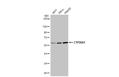 Anti-CYP26A1 antibody used in Western Blot (WB). GTX104961