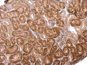 Anti-BPNT1 antibody [N1C3] used in IHC (Paraffin sections) (IHC-P). GTX104970