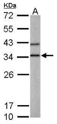 Anti-BPNT1 antibody [N1C3] used in Western Blot (WB). GTX104970