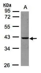 Anti-BPNT1 antibody [N1C3] used in Western Blot (WB). GTX104970
