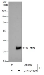 Anti-MTHFD2 antibody [N1C3] used in Immunoprecipitation (IP). GTX104990