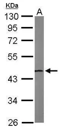 Anti-NSFL1C antibody [N1C2] used in Western Blot (WB). GTX105035