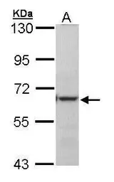 Anti-METTL3 antibody [N2C2], Internal used in Western Blot (WB). GTX105037