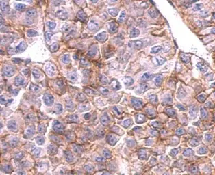 Anti-SLC20A1 antibody [N3C2], Internal used in IHC (Paraffin sections) (IHC-P). GTX105062