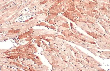 Anti-OGDH antibody [C2C3], C-term used in IHC (Paraffin sections) (IHC-P). GTX105124