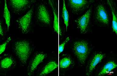 Anti-OGDH antibody [C2C3], C-term used in Immunocytochemistry/ Immunofluorescence (ICC/IF). GTX105124