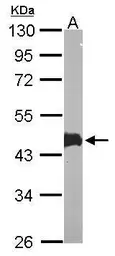 Anti-MAPKAP Kinase 3 antibody [N2C3] used in Western Blot (WB). GTX105147