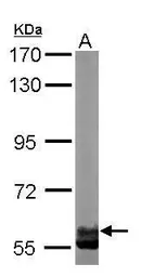 Anti-TCP1 zeta antibody [N2C2], Internal used in Western Blot (WB). GTX105148