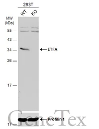 Anti-ETFA antibody used in Western Blot (WB). GTX105155