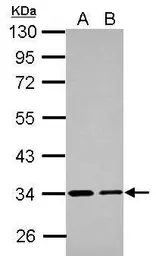 Anti-ETFA antibody used in Western Blot (WB). GTX105155