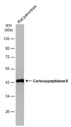 Anti-Carboxypeptidase B antibody [N1C1] used in Western Blot (WB). GTX105170