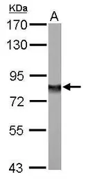 Anti-NDUFS1 antibody used in Western Blot (WB). GTX105270