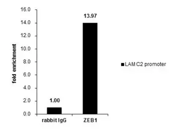 Anti-ZEB1 antibody [N2C1], Internal used in ChIP assay (ChIP assay). GTX105278