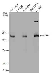 Anti-ZEB1 antibody [N2C1], Internal used in Western Blot (WB). GTX105278