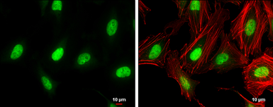 Anti-ZEB1 antibody [N2C1], Internal used in Immunocytochemistry/ Immunofluorescence (ICC/IF). GTX105278