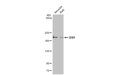 Anti-ZEB1 antibody [N2C1], Internal used in Western Blot (WB). GTX105278