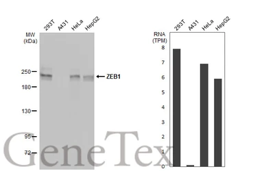 Anti-ZEB1 antibody [N2C1], Internal used in Western Blot (WB). GTX105278