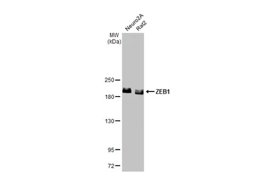 Anti-ZEB1 antibody [N2C1], Internal used in Western Blot (WB). GTX105278