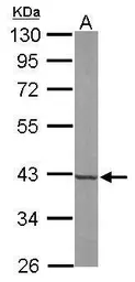 Anti-FDPS antibody [N1C3] used in Western Blot (WB). GTX105301