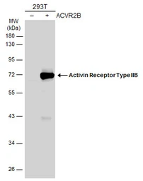Anti-Activin Receptor Type IIB antibody [N1C1] used in Western Blot (WB). GTX105330