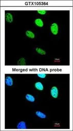 Anti-BRCC45 antibody used in Immunocytochemistry/ Immunofluorescence (ICC/IF). GTX105364