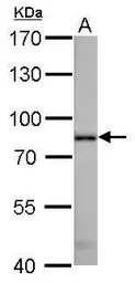 Anti-Radixin antibody used in Western Blot (WB). GTX105408