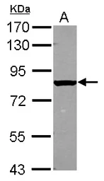 Anti-Radixin antibody used in Western Blot (WB). GTX105408
