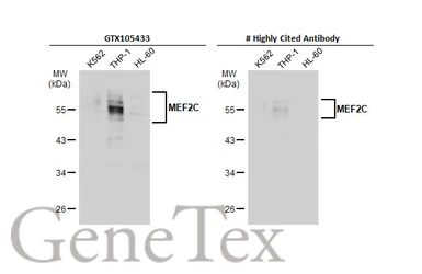 Anti-MEF2C antibody used in Western Blot (WB). GTX105433