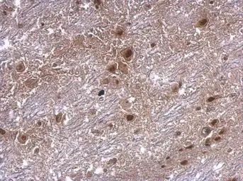 Anti-Axin 2 antibody [N2C2], Internal used in IHC (Paraffin sections) (IHC-P). GTX105442