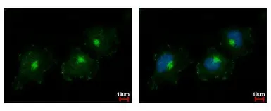 Anti-C1s antibody used in Immunocytochemistry/ Immunofluorescence (ICC/IF). GTX105464