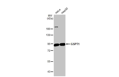 Anti-GSPT1 antibody used in Western Blot (WB). GTX105475