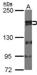 Anti-ZNF198 antibody used in Western Blot (WB). GTX105550