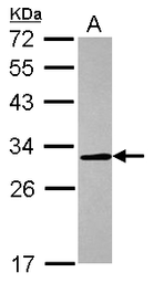 Anti-Carbonic Anhydrase II antibody [N1C3] used in Western Blot (WB). GTX105562