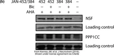Anti-PP1C gamma antibody [N1C2] used in Western Blot (WB). GTX105618