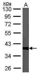 Anti-PP1C gamma antibody [N1C2] used in Western Blot (WB). GTX105618