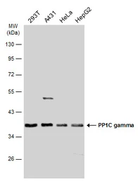 Anti-PP1C gamma antibody [N1C2] used in Western Blot (WB). GTX105618