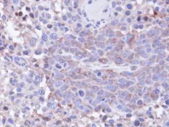 Anti-PP1C gamma antibody [N1C2] used in IHC (Paraffin sections) (IHC-P). GTX105618