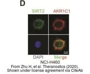 Anti-AKR1C1 antibody used in Immunocytochemistry/ Immunofluorescence (ICC/IF). GTX105620