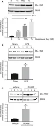 Anti-AKR1C1 antibody used in Western Blot (WB). GTX105620