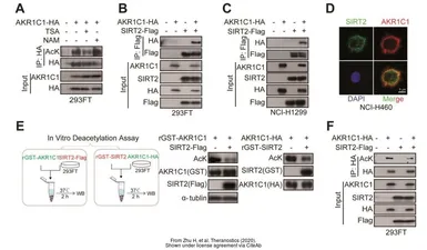 Anti-AKR1C1 antibody used in Western Blot (WB). GTX105620