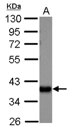Anti-AKR1C1 antibody used in Western Blot (WB). GTX105620