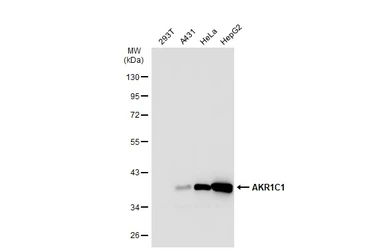Anti-AKR1C1 antibody used in Western Blot (WB). GTX105620