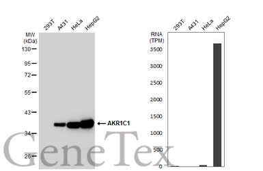 Anti-AKR1C1 antibody used in Western Blot (WB). GTX105620
