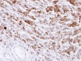 Anti-AKR1C1 antibody used in IHC (Paraffin sections) (IHC-P). GTX105620