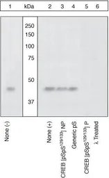 Anti-CREB (phospho Ser129/Ser133) antibody used in Western Blot (WB). GTX10564